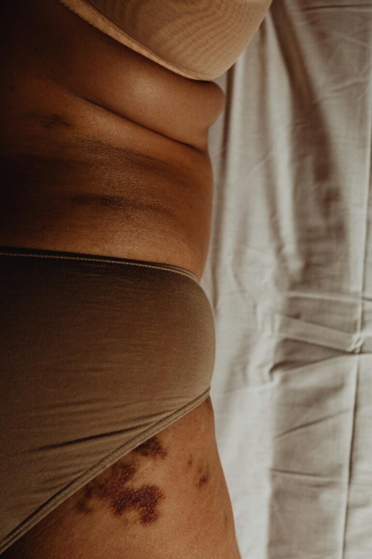A detailed shot focusing on a woman's body, highlighting natural folds and bruises in a realistic setting.